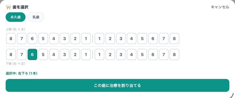 歯を選択の画面。永久歯と乳歯の切り替え、上顎と下顎の歯式、右下6を選択中
