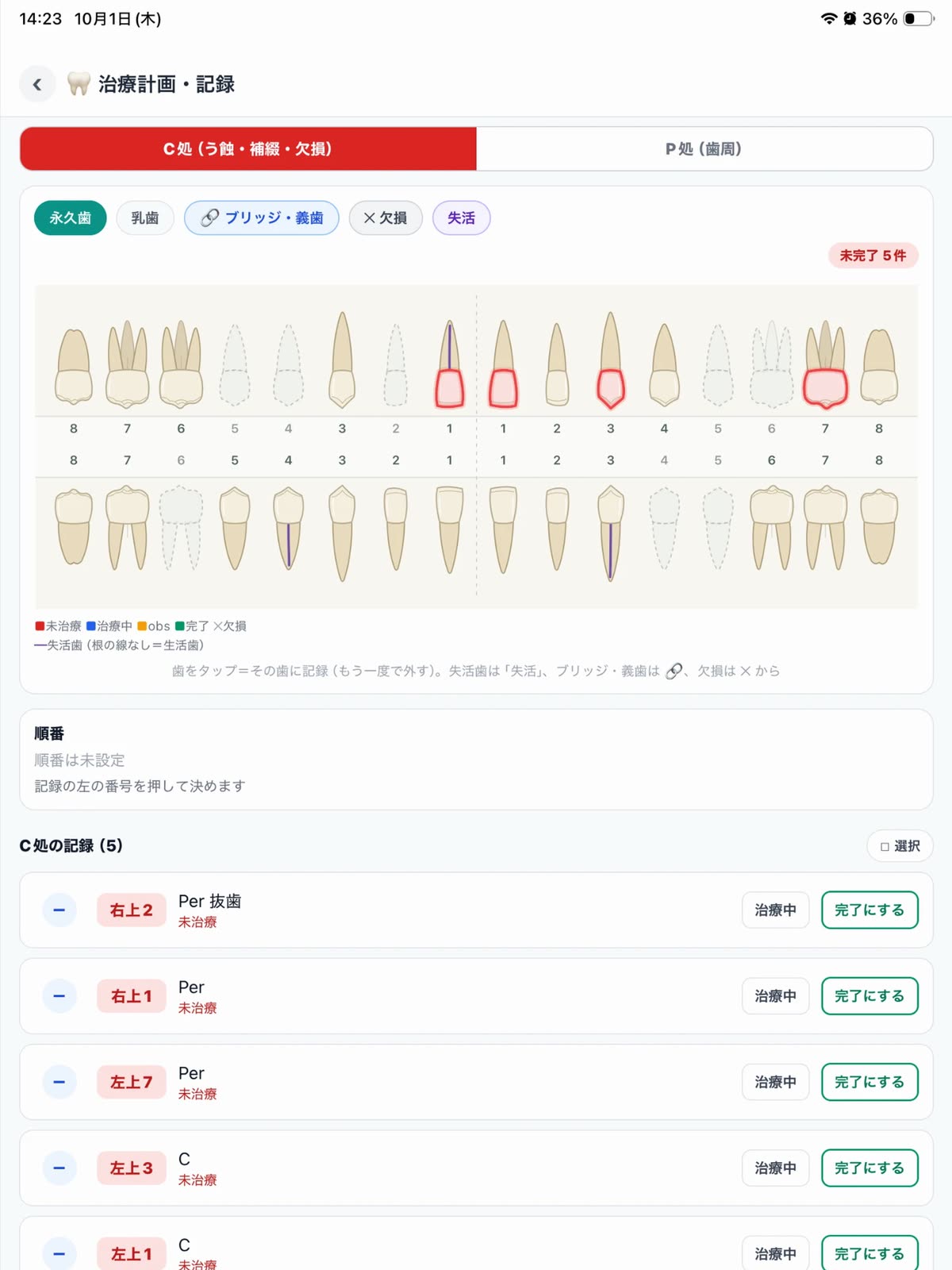 治療計画の画面。歯式の図に、予定している治療が歯ごとに色で示されている